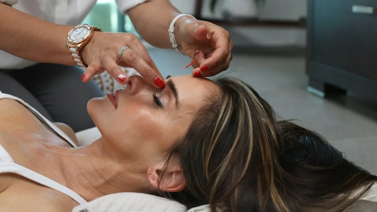 Acupuncture pour le stress : mode d’emploi